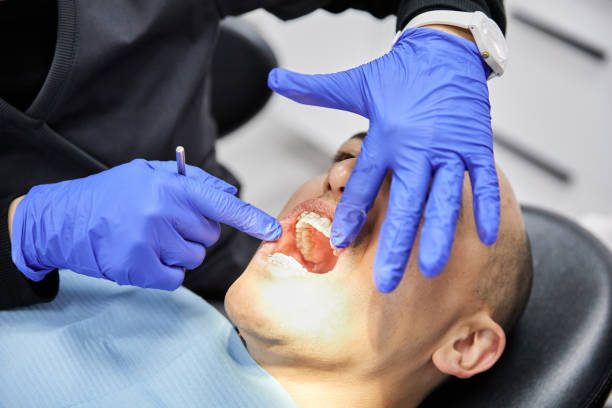 Best Chipped Tooth Repair Near Me  in Orange Blossom, CA