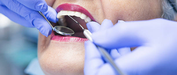 Tooth Infection Emergency Dentist in CA